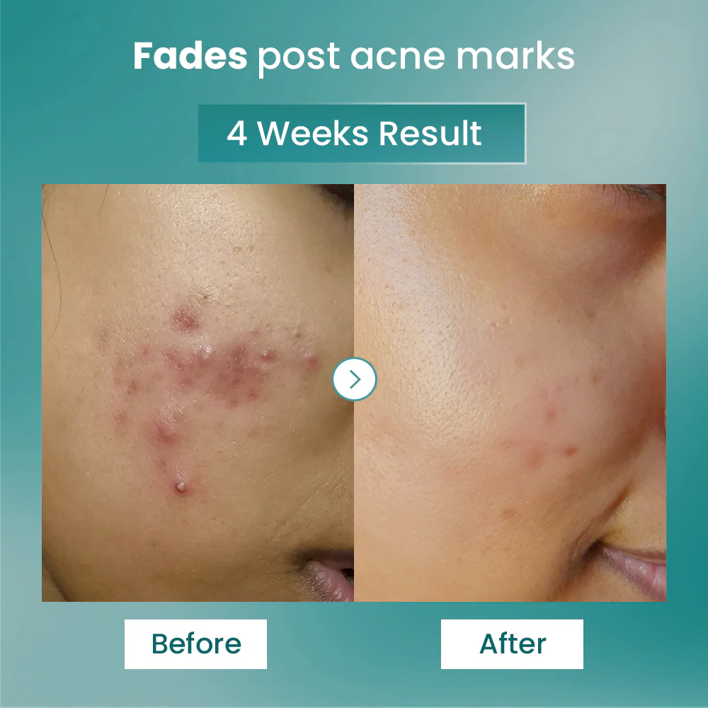 Spot Fade Advanced Repair Serum - Image 3